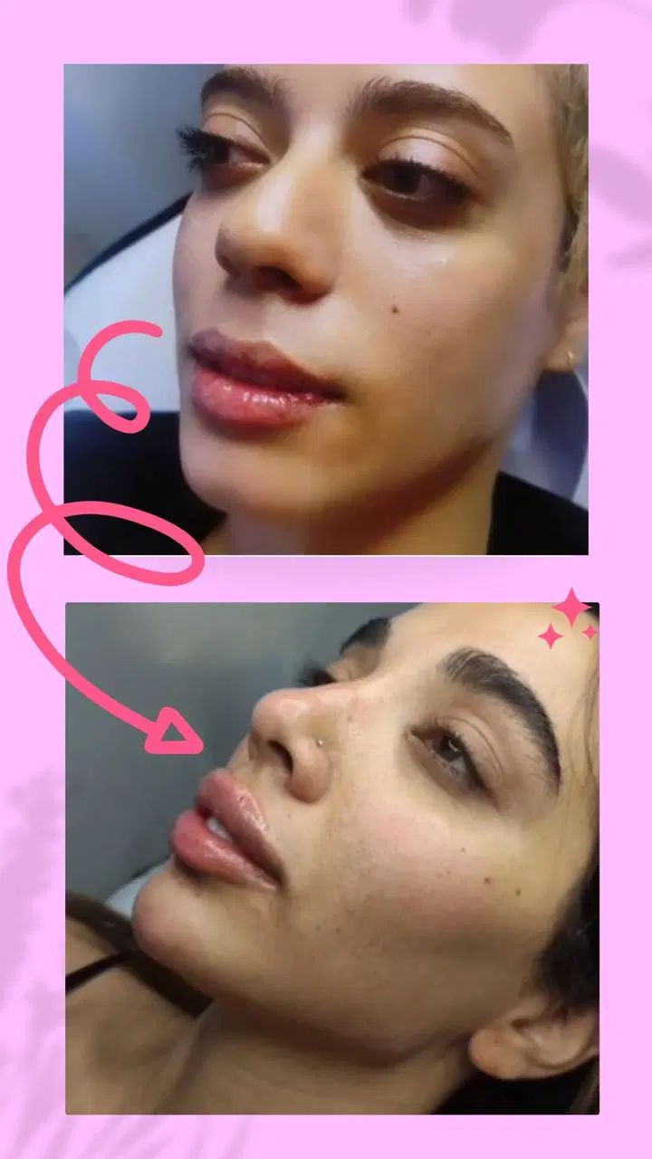 تخفیف ویژه کلینیک زیبایی لوکس و مجهز در نسیم شهر|خدمات آرایشگری و زیبایی|نسیم‌شهر, |دیوار