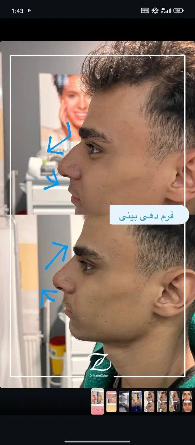 بینی|آرایشی، بهداشتی، درمانی|تهران, آسمان|دیوار