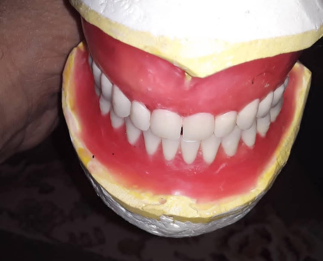 ساخت دندان مصنوعی|آرایشی، بهداشتی، درمانی|لردگان, |دیوار