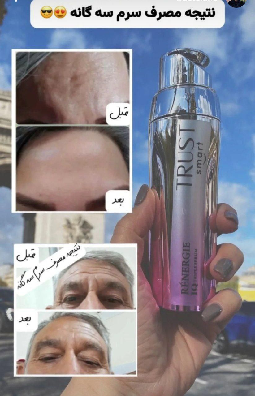 کرم و سرم سگانه هوشمند|آرایشی، بهداشتی، درمانی|مشهد, ولیعصر (امامیه)|دیوار