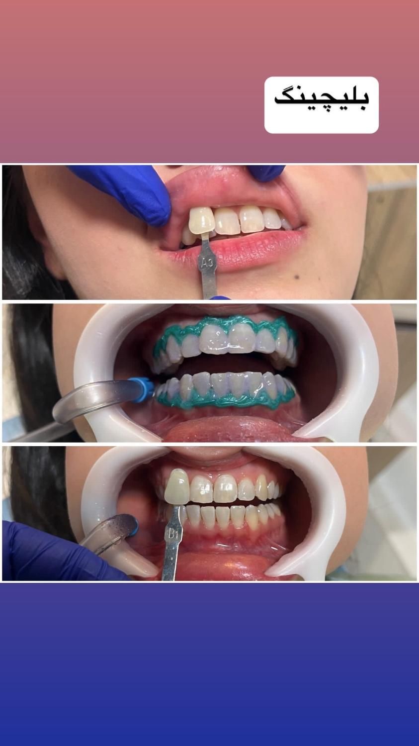 خدمات دندانپزشکی|خدمات آرایشگری و زیبایی|رشت, گلسار|دیوار