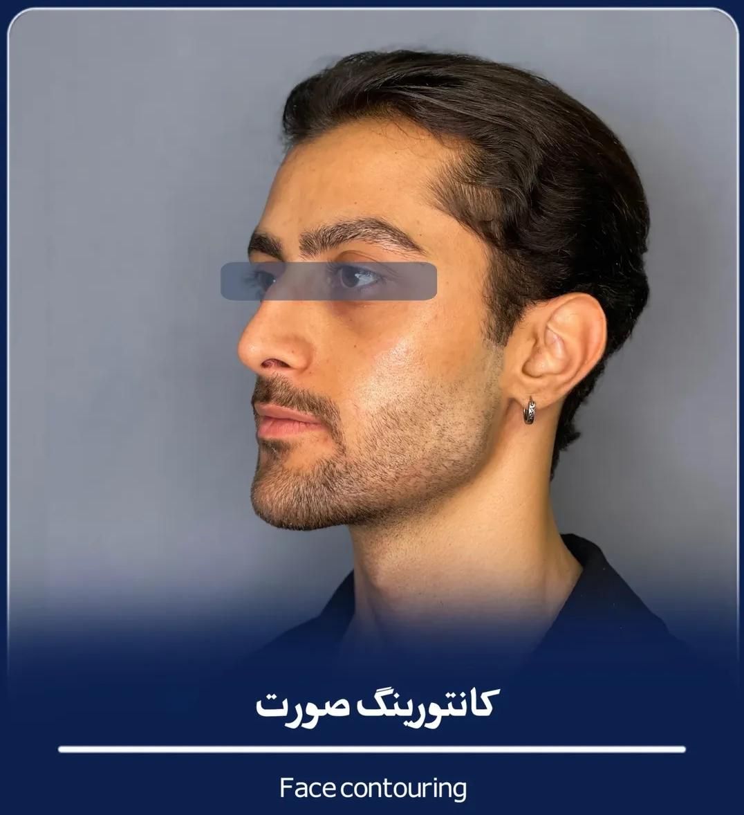 فیلر بادی ژل لب بوتاکس نخ لیفت فیلر بینی آنزیم لب|خدمات آرایشگری و زیبایی|اصفهان, باغ نگاره|دیوار
