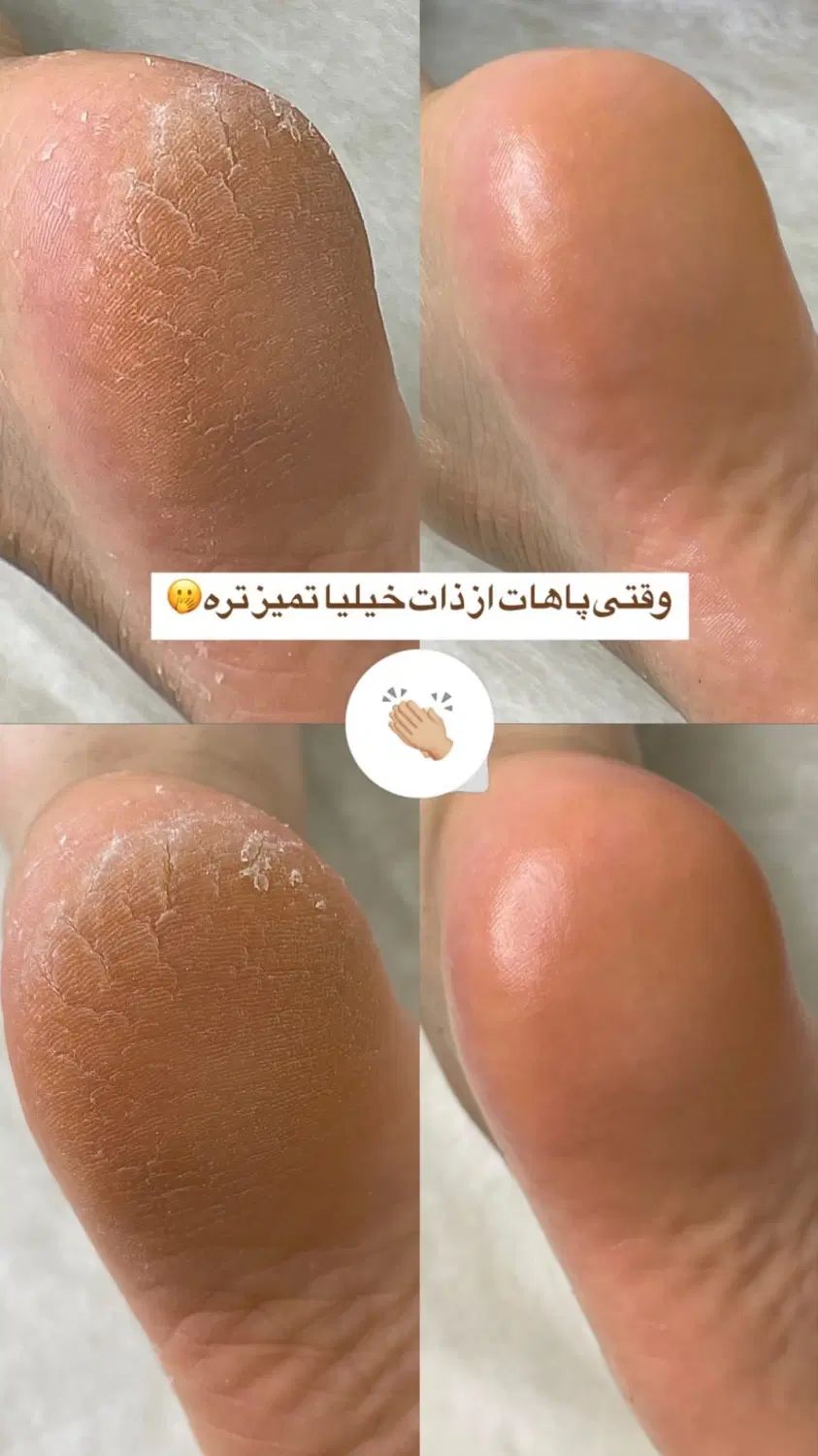 برای تکمیل پیچ نیاز ب مدل دارم برای پدیکور وکراتین|خدمات آرایشگری و زیبایی|اسلام‌شهر, شهرک واوان|دیوار