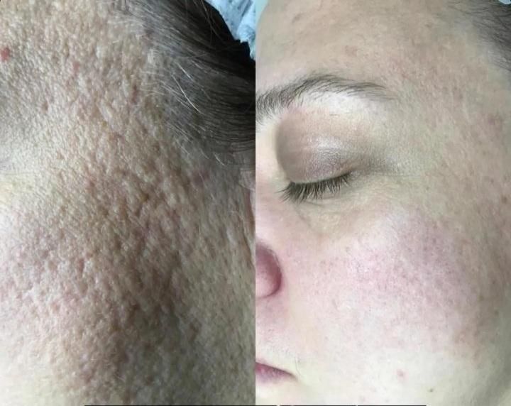 انجام کلیه خدمات پاکسازی پوست بصورت کاملا تخصصی|خدمات آرایشگری و زیبایی|سرپل ذهاب, |دیوار