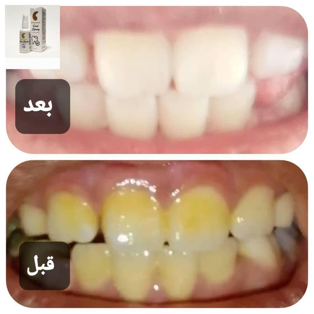 جرمگیر دندان|حراج|اصفهان, شهریار|دیوار