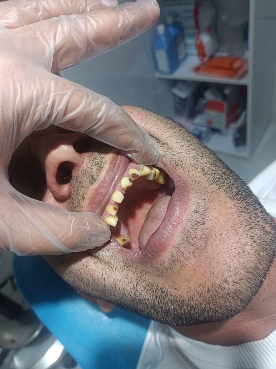 دندان سازی|خدمات آرایشگری و زیبایی|خوی, |دیوار