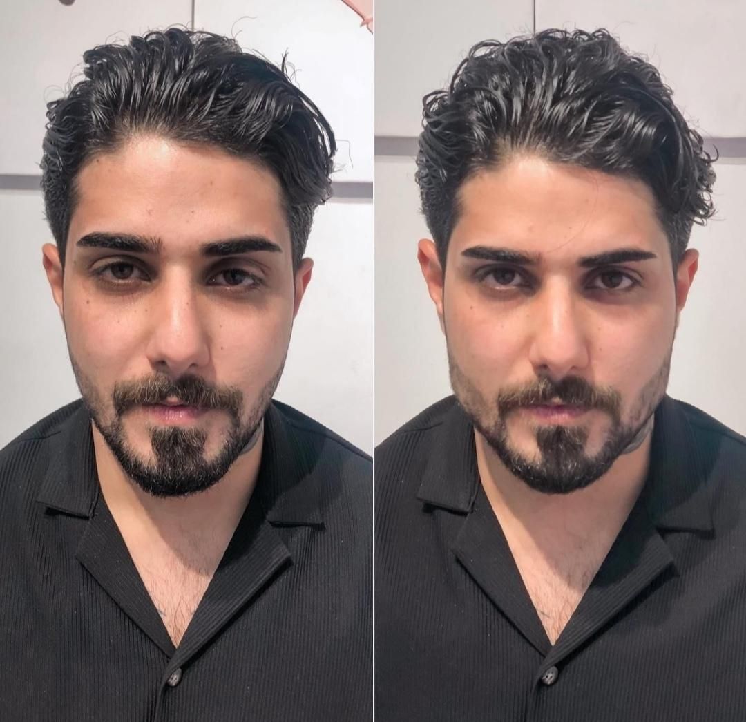 فیلر بادی ژل لب بوتاکس نخ لیفت فیلر بینی آنزیم لب|خدمات آرایشگری و زیبایی|اصفهان, باغ نگاره|دیوار