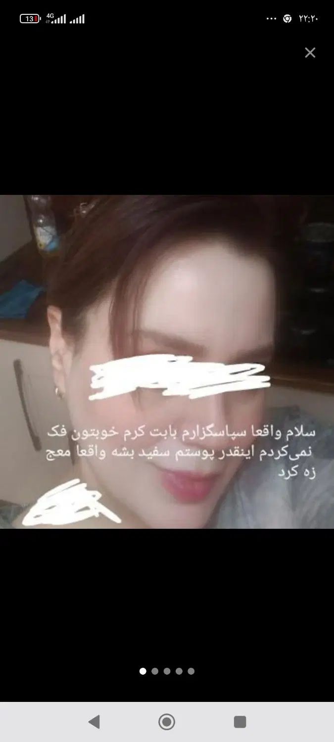 کرم اصلی تضمینی معجزه بدون کورتون وبازگشت لکه|آرایشی، بهداشتی، درمانی|کرمانشاه, |دیوار