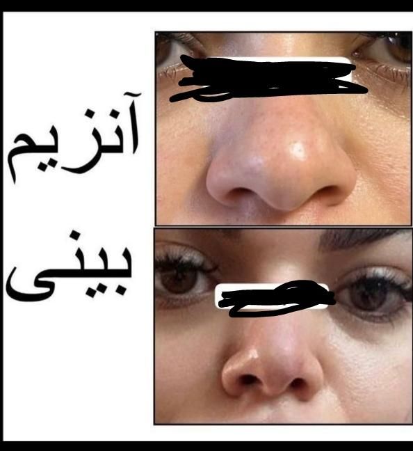 انزیم بینی|خدمات آرایشگری و زیبایی|الشتر, |دیوار