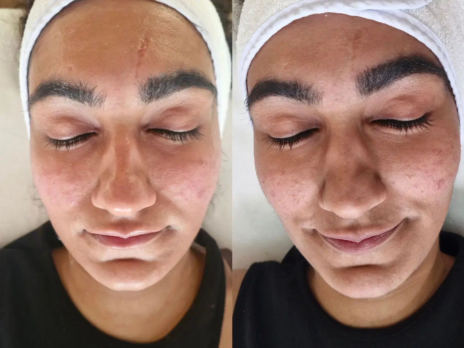 فیشال تخصصی ،پاکسازی پوست|خدمات آرایشگری و زیبایی|اصفهان, چشمه باقرخان|دیوار