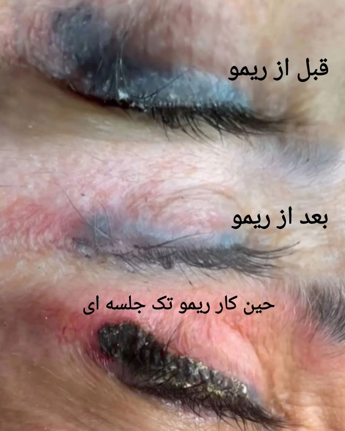 ریمو ابرو،چشم ولب|خدمات آرایشگری و زیبایی|تهران, افسریه شمالی|دیوار