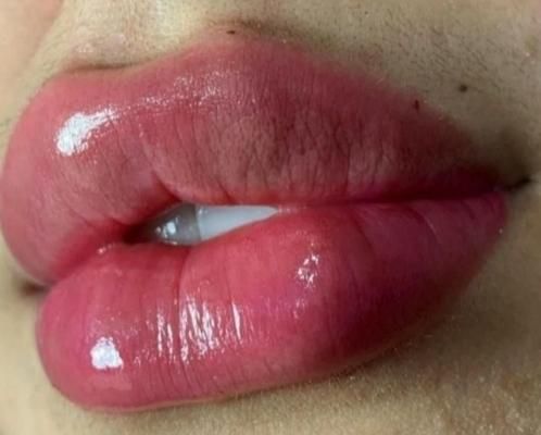 خدمات ژل وبوتاکس ورنگ ولایت|خدمات آرایشگری و زیبایی|اهواز, بهارستان|دیوار