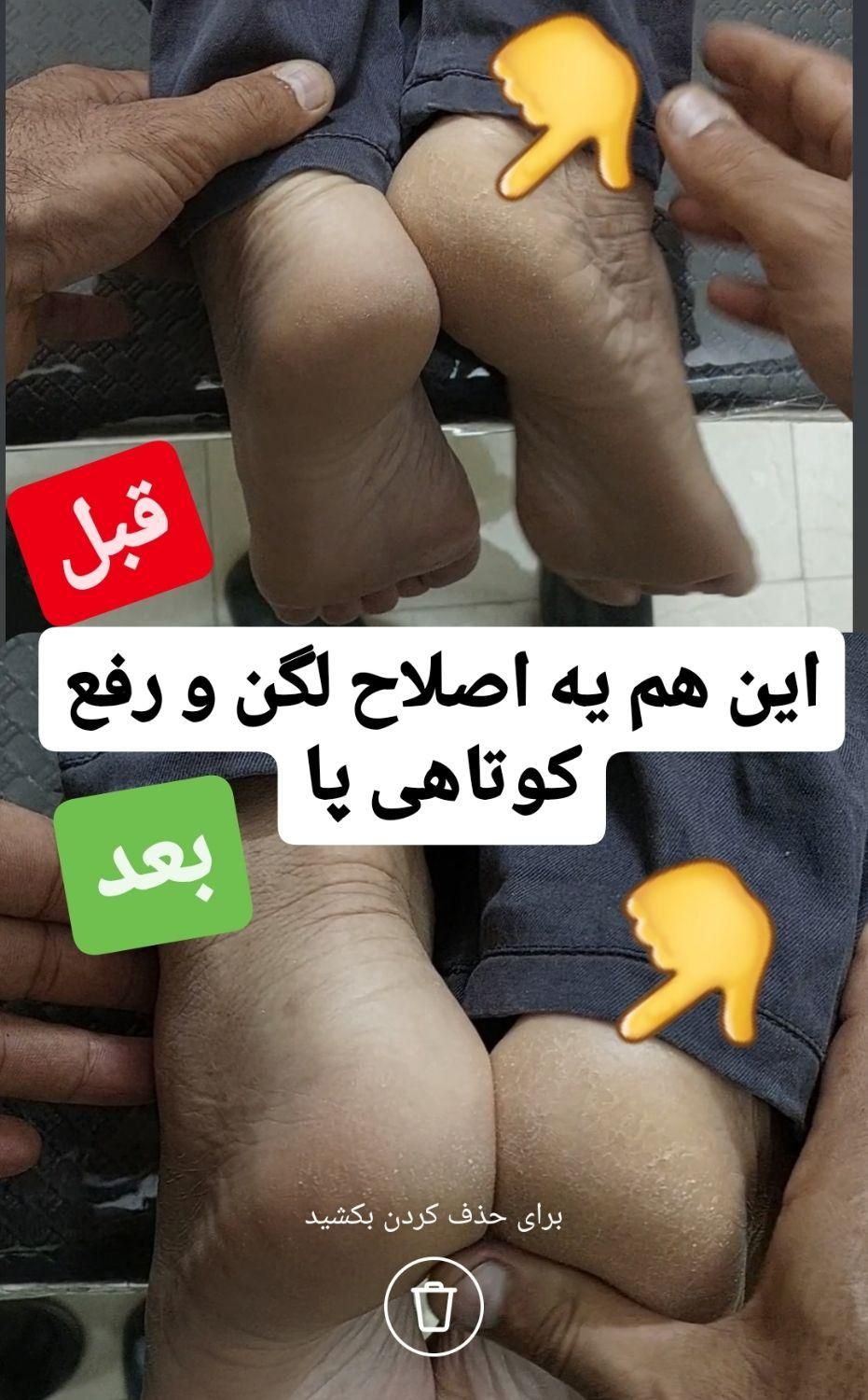 رگگیری.اصلاحی.زالودرمانی.حجامت.اصلاحی|خدمات آرایشگری و زیبایی|کاشان, دشت چال|دیوار