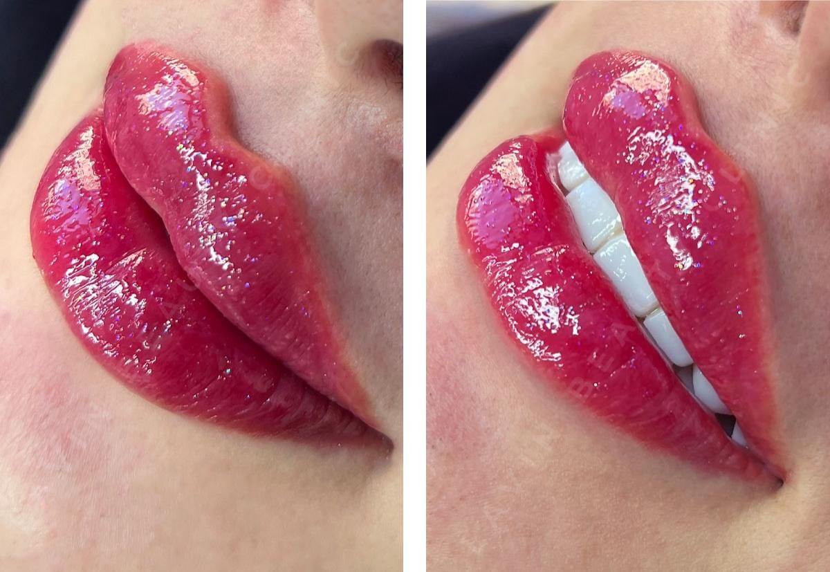 تزریق ژل فیلر بوتاکس مزو و لیزر در کلینیک زیبایی|خدمات آرایشگری و زیبایی|رباطکریم, رباطکریم|دیوار