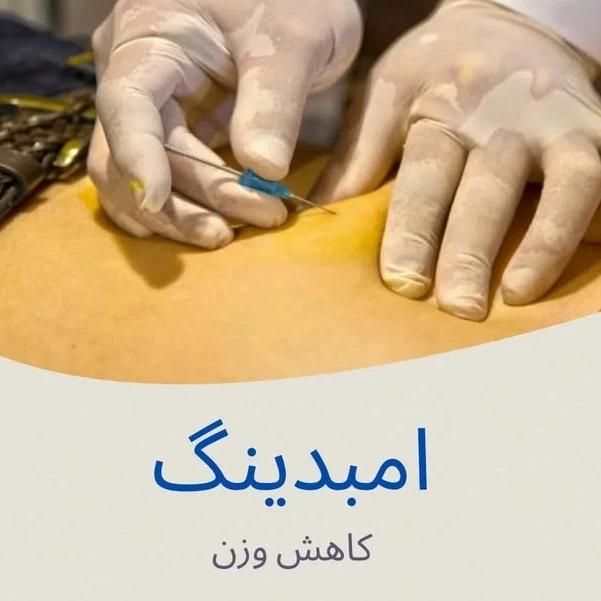 امبدینگ حجامت طب سوزنی بادکش زالو فصد خون|خدمات آرایشگری و زیبایی|اصفهان, باغ زرشک|دیوار