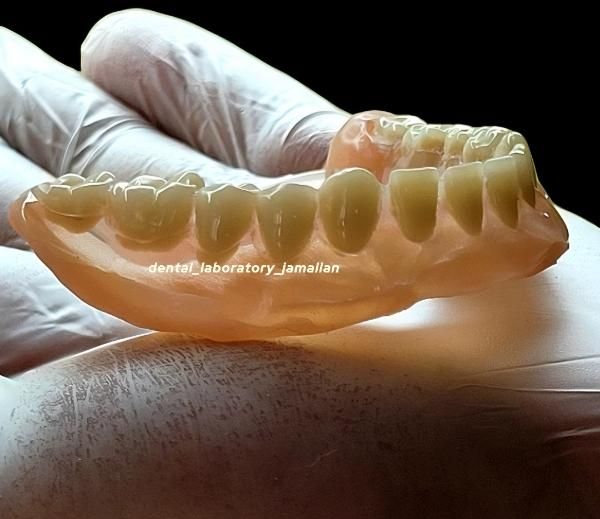 ساخت دندان مصنوعی اقساط با چک صیادی|خدمات آرایشگری و زیبایی|پردیس, فاز ۸|دیوار