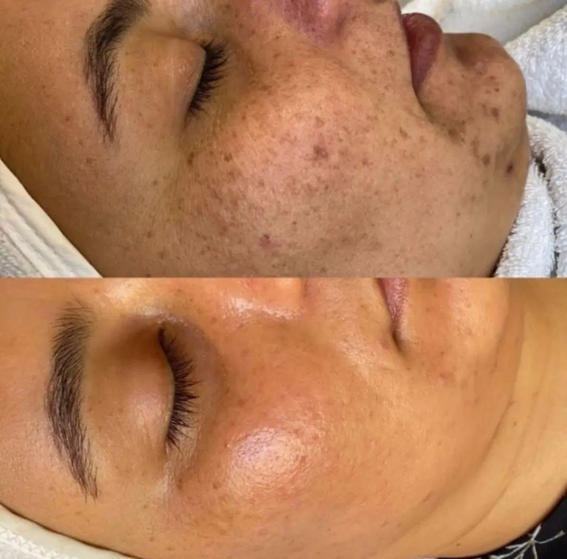 آموزش و خدمات تکنیک پوست مار و مزونیدلینگ|خدمات آرایشگری و زیبایی|اسلام‌شهر, باغ فیض|دیوار
