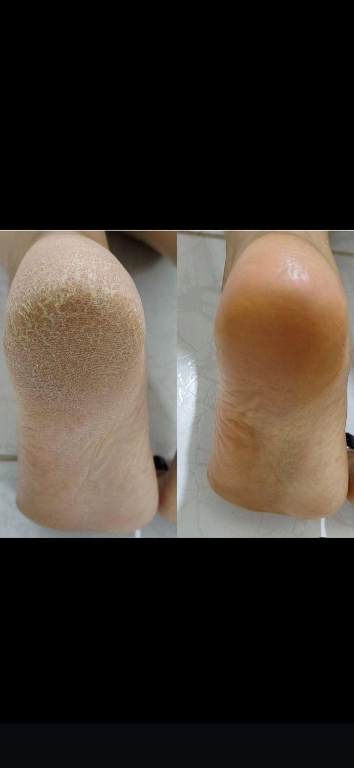 پدیکور واپیلاسیون|خدمات آرایشگری و زیبایی|مسجد سلیمان, |دیوار