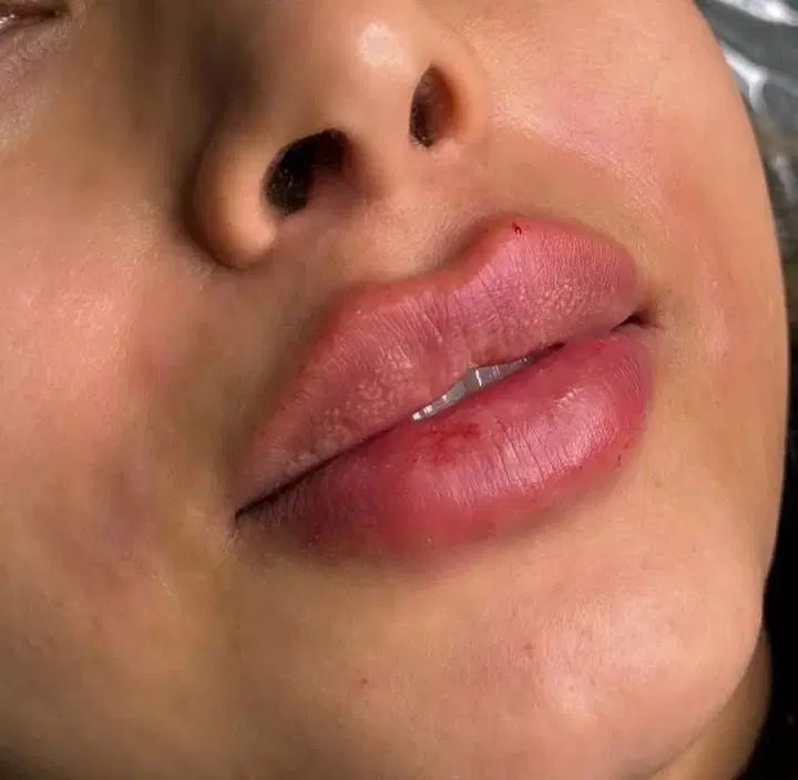 ژل و بوتاکس 550آموزش4م.باکمترین هزینه بدرخشید.|خدمات آرایشگری و زیبایی|شهریار, شهریار|دیوار