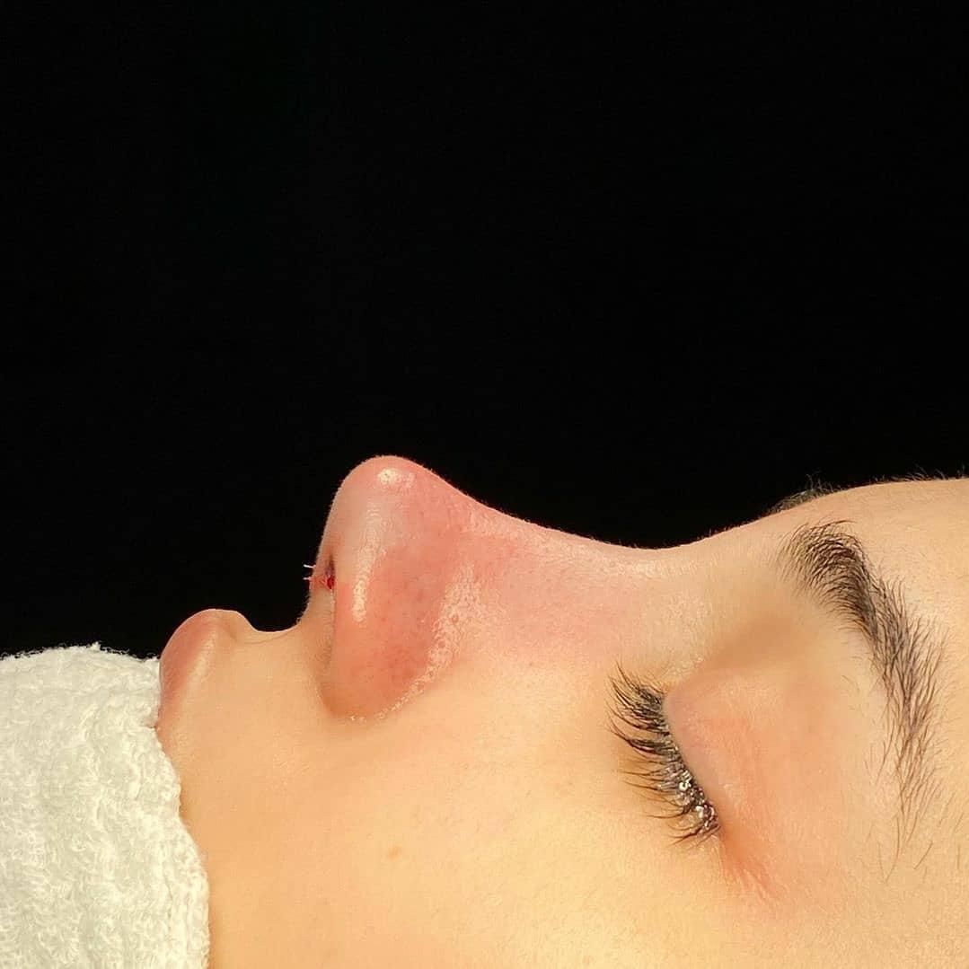 عمل جراحی زیبایی بینی،لیفت صورت،گوش|خدمات آرایشگری و زیبایی|تهران, تهرانپارس غربی|دیوار
