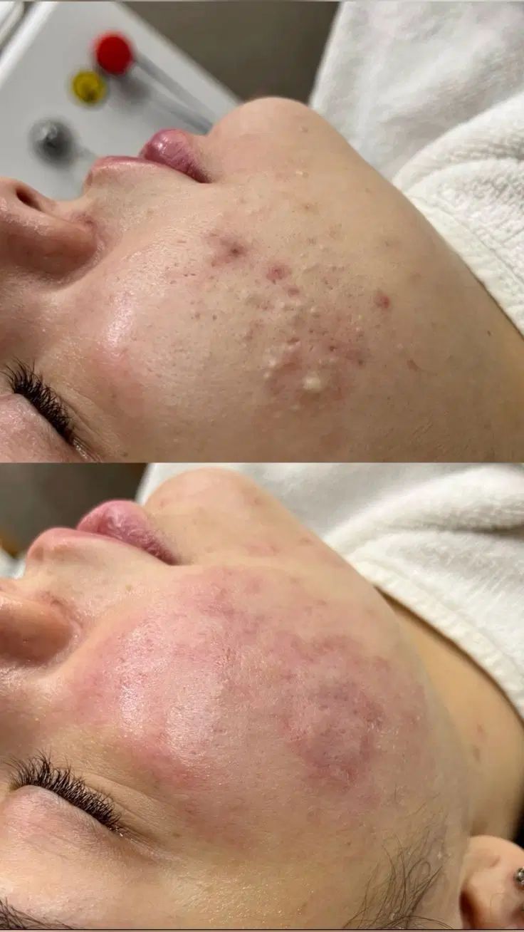 فقط تا یک هفته جهت تکمیل رزومه|خدمات آرایشگری و زیبایی|رشت, سعدی (تختی)|دیوار