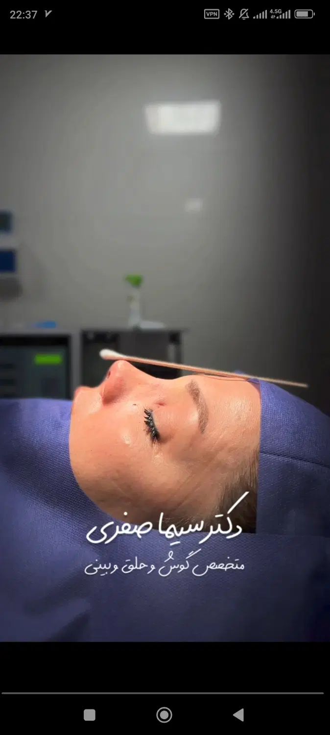 جراحی زیبایی بینی صفرتاصد ۲۹تومان متخصص(ent)|خدمات آرایشگری و زیبایی|تهران, یوسف‌آباد|دیوار