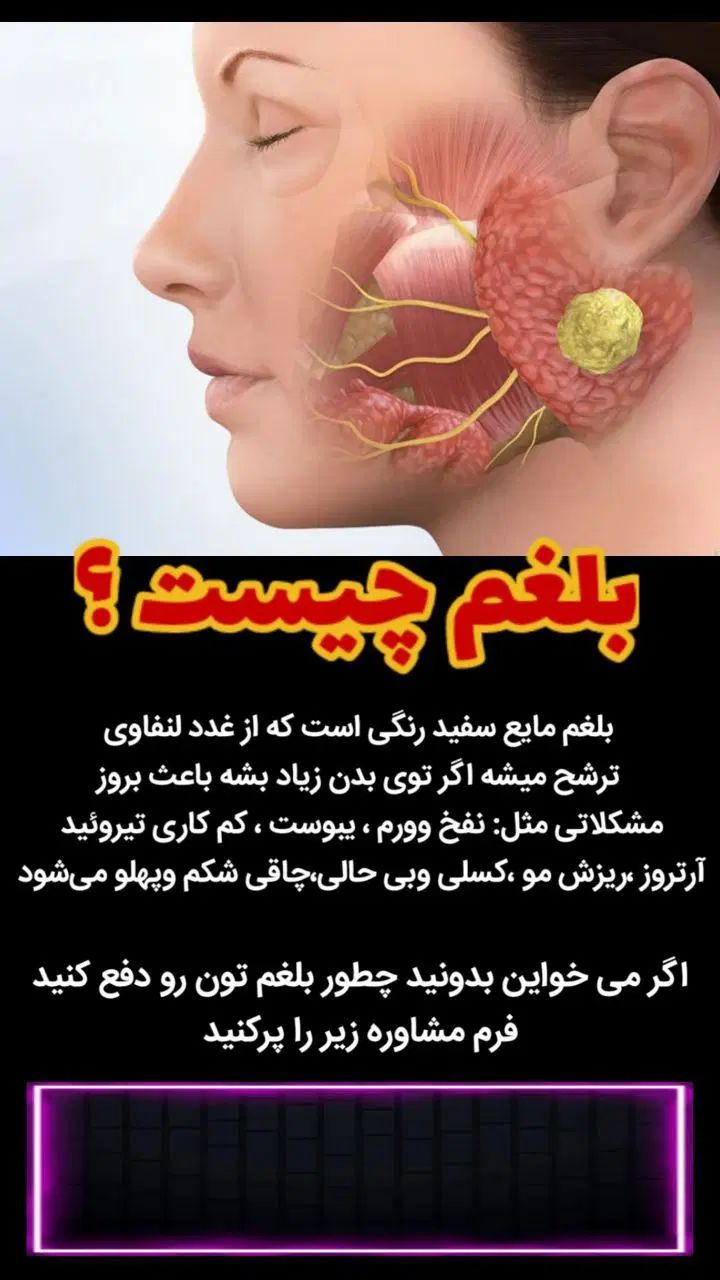 درمان بلغم|آرایشی، بهداشتی، درمانی|رشت, اسماعیل آباد|دیوار