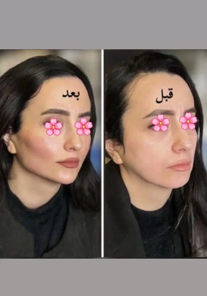 تخفیف ویژه کلینیک زیبایی لوکس و مجهز در نسیم شهر|خدمات آرایشگری و زیبایی|نسیم‌شهر, |دیوار