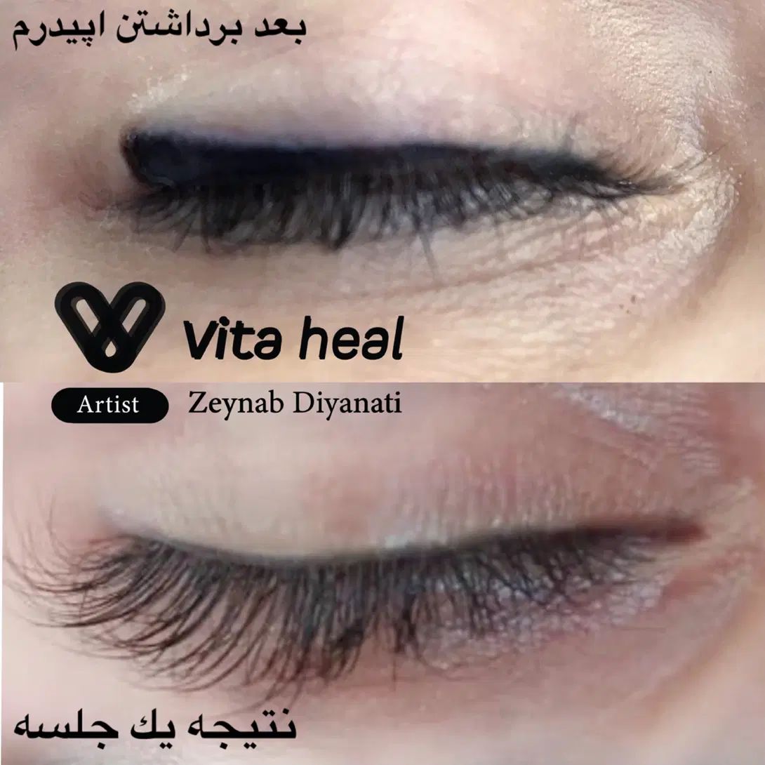 مدل ریموو تتو ابرو،خط چشم و خط لب|خدمات آرایشگری و زیبایی|رشت, بلوار گیلان|دیوار
