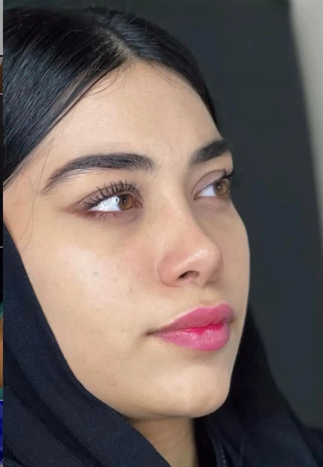 عمل بینی با متخصص بالای ۱۰۰۰ عمل موفق فقط با ۲۳ م|خدمات آرایشگری و زیبایی|تهران, جمال‌زاده|دیوار