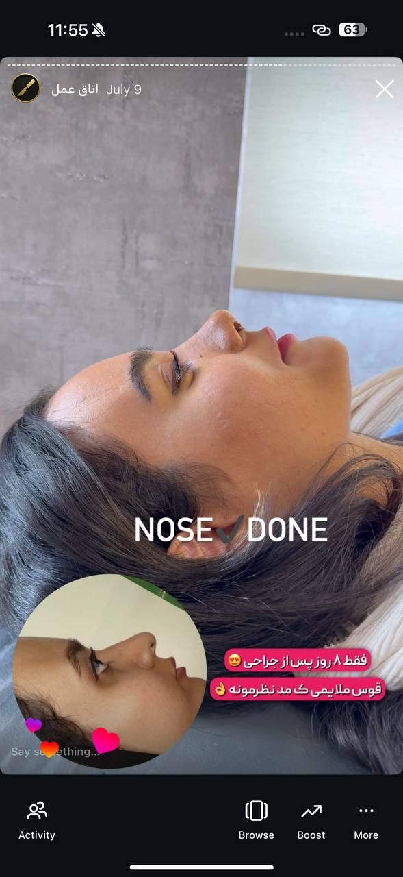 عمل بینی فقط« ۲۹ »میلیون روز ۸  و ۹ اذر|خدمات آرایشگری و زیبایی|تهران, پاسداران|دیوار