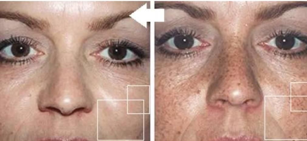 فروش مواد زگیل تناسلی تضمینی با ی بار استفاده|خدمات آرایشگری و زیبایی|یاسوج, |دیوار