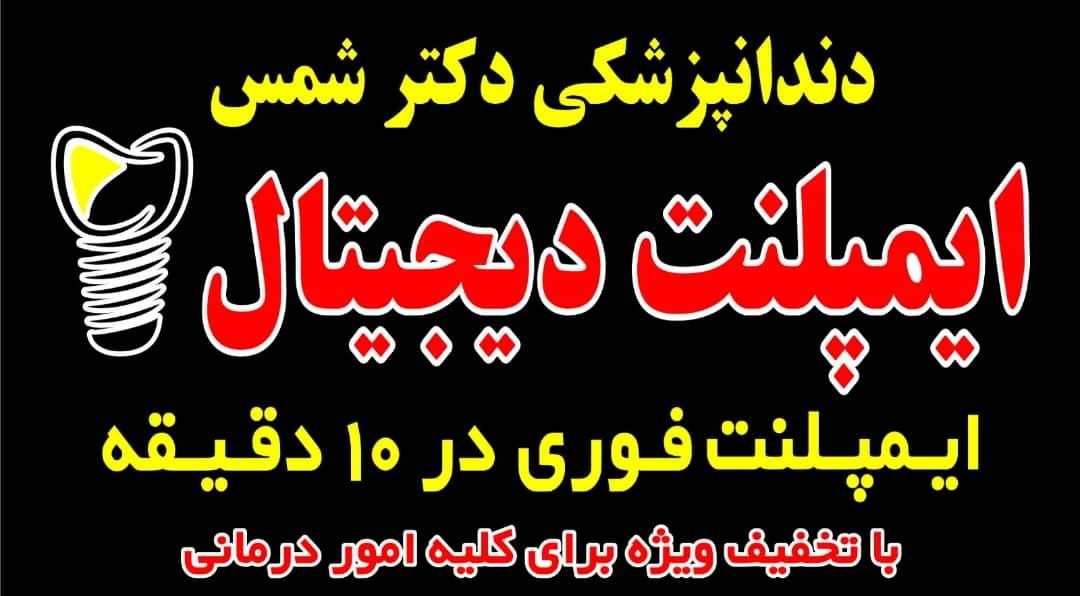 دندانپزشکی/ تخفیف ویژه تابستان/ ایمپلنت دیجیتال|خدمات آرایشگری و زیبایی|تهران, گلستان (شهرک راه آهن)|دیوار