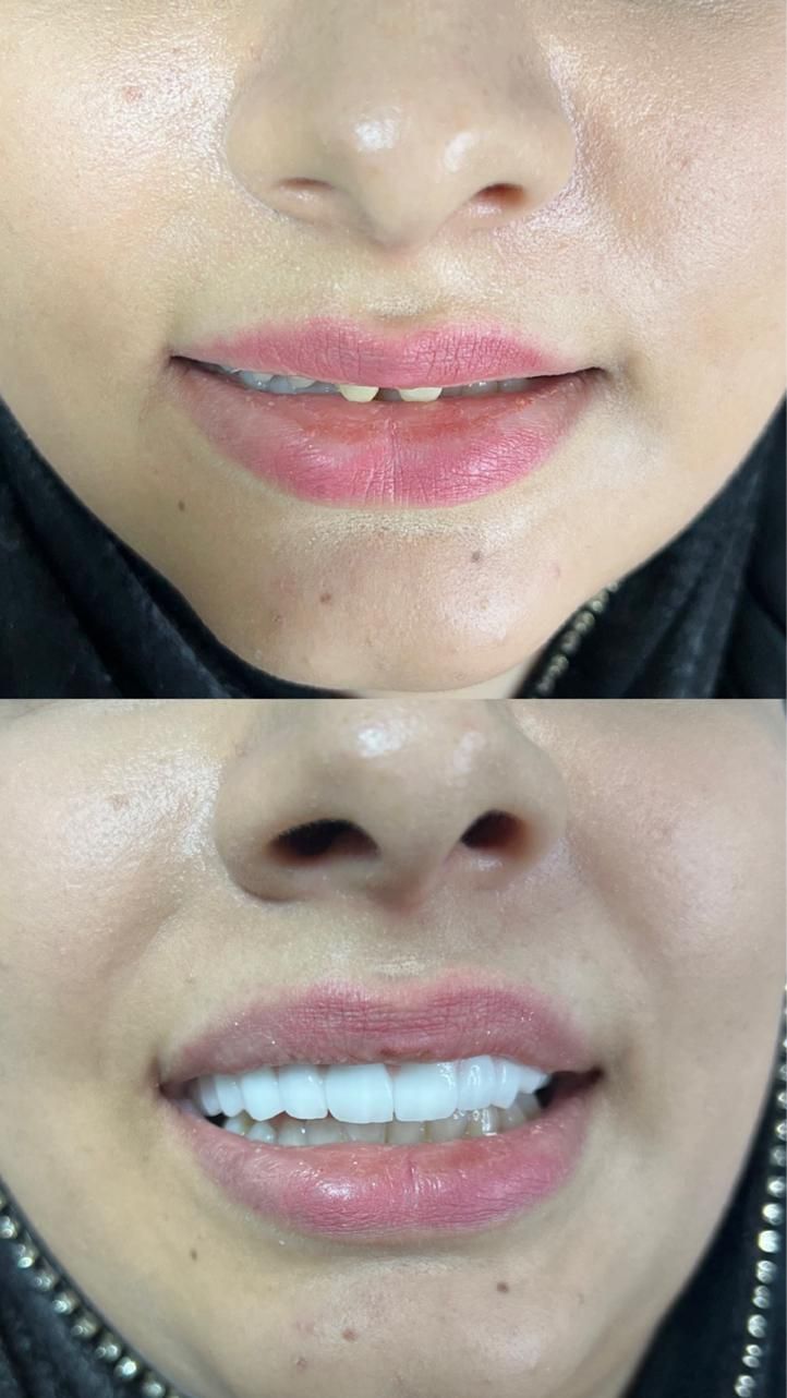 دندانپزشکی سپید|خدمات آرایشگری و زیبایی|تبریز, |دیوار