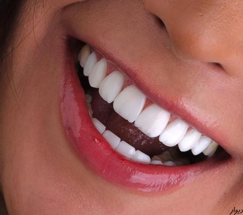 تمامی خدمات دندانپزشکی و کامپوزیت و فیسینگ|خدمات آرایشگری و زیبایی|شیراز, فرهنگ شهر|دیوار