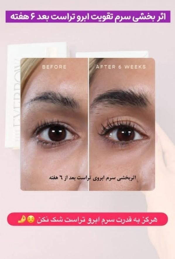 سرم رویش و تقویت ابرو|آرایشی، بهداشتی، درمانی|اصفهان, گلستان|دیوار