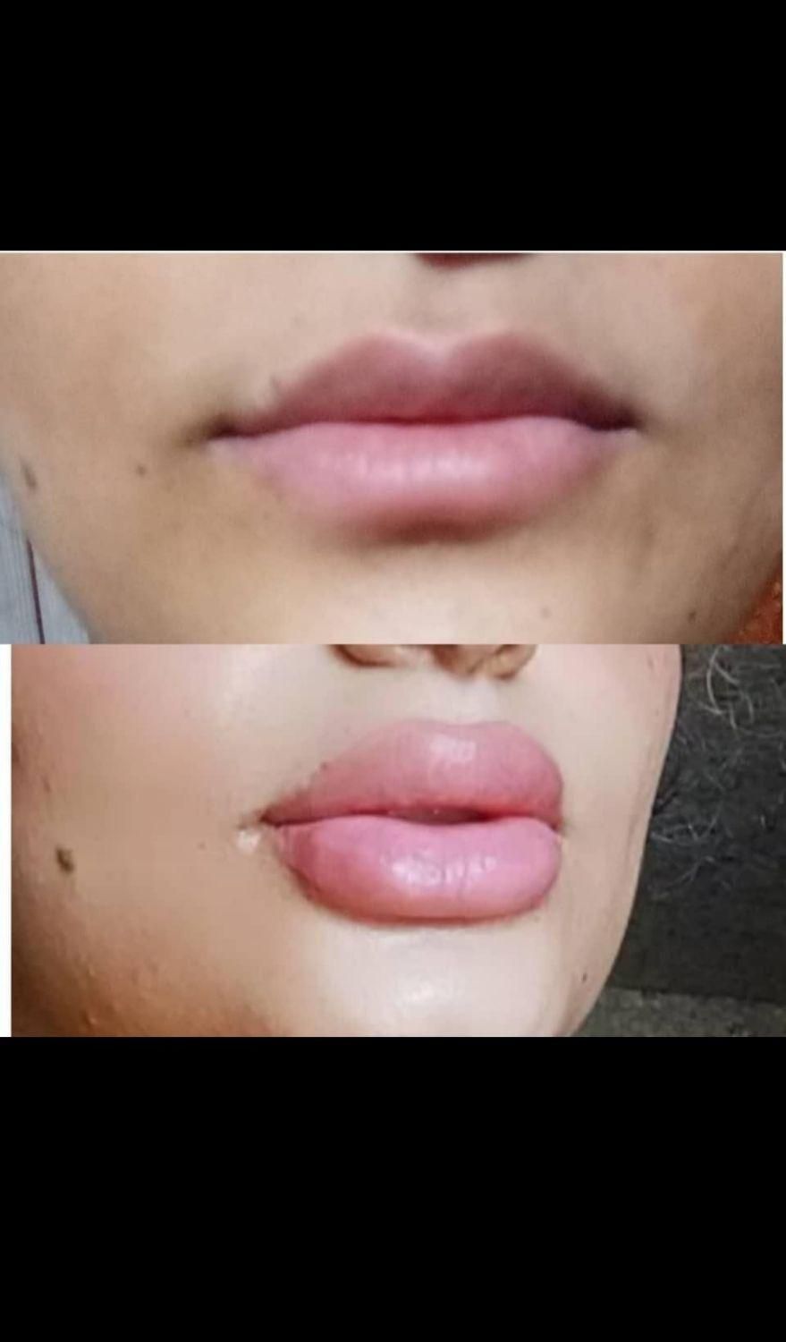 انجام خدمات ژل و بوتاکس|خدمات آرایشگری و زیبایی|اسلامشهر, شهرک مصطفی خمینی|دیوار