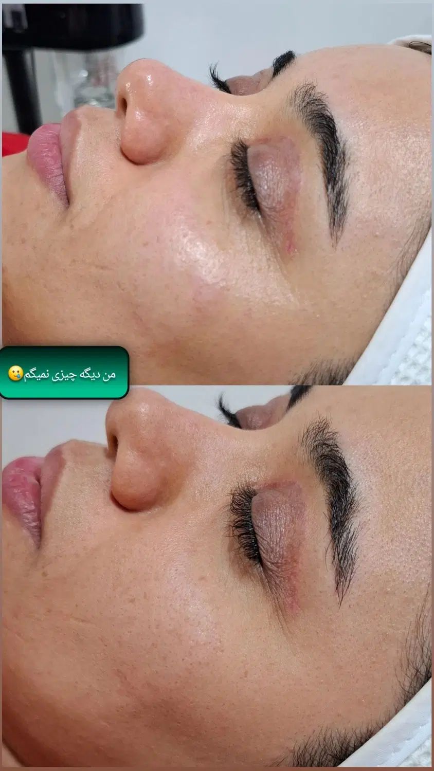 فیشیال تخصصی با بهترین برندو متریال کره ای|خدمات آرایشگری و زیبایی|رامهرمز, |دیوار