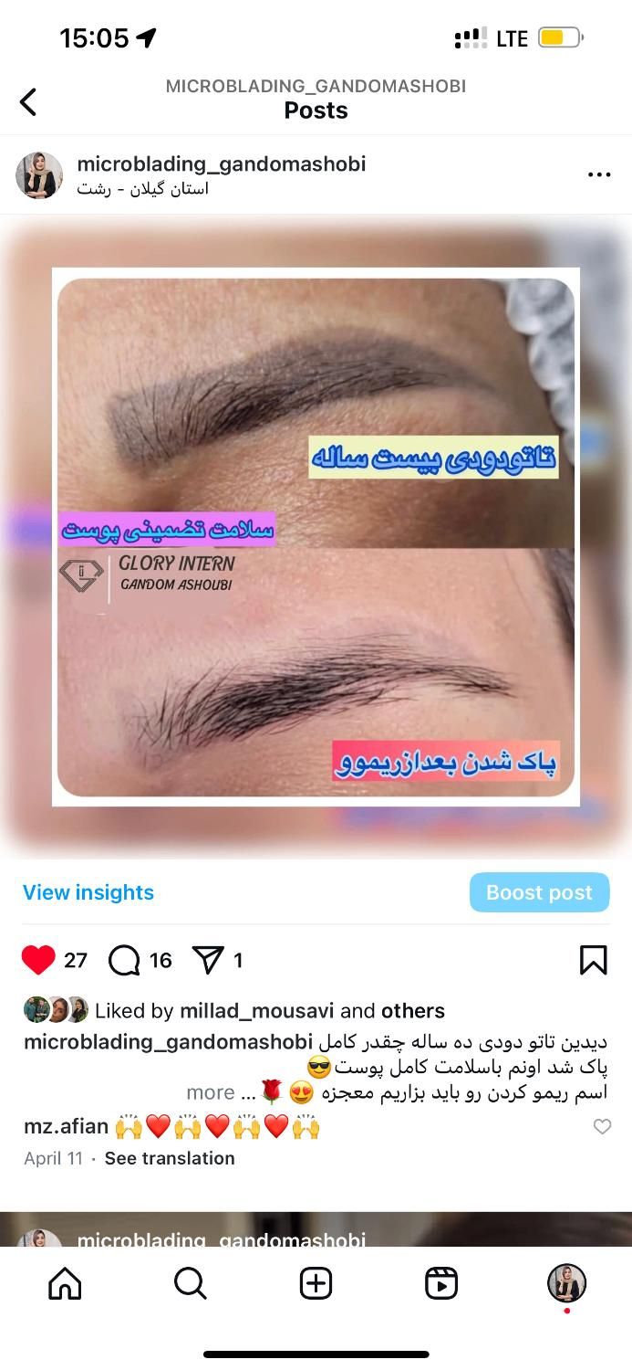 ریموو(پاک کردن تاتو)،میکروبلیدینگ،تاتوابرو|خدمات آرایشگری و زیبایی|رشت, منظریه|دیوار