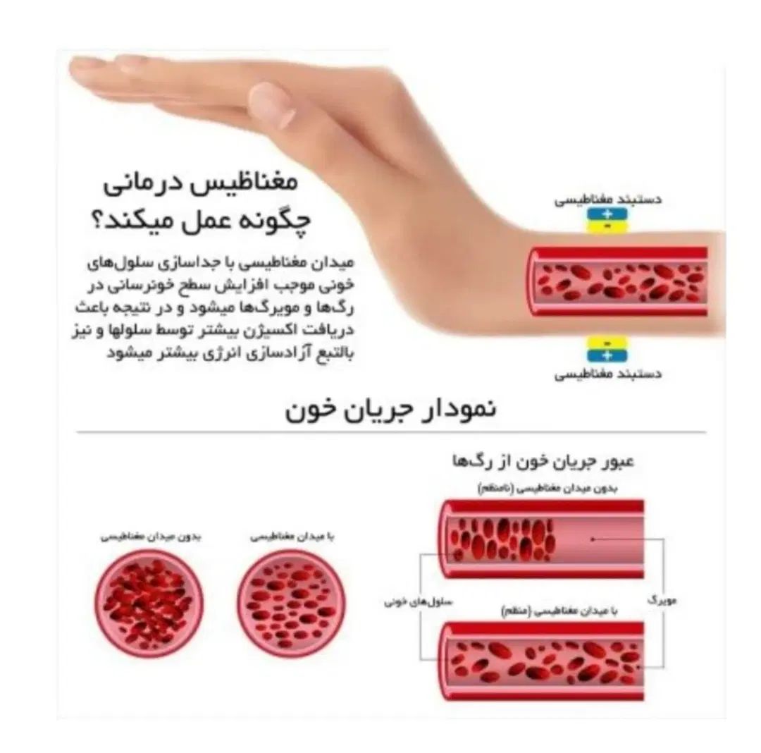 دستبند مغناطیسی|بدلیجات|تهران, کرمان|دیوار