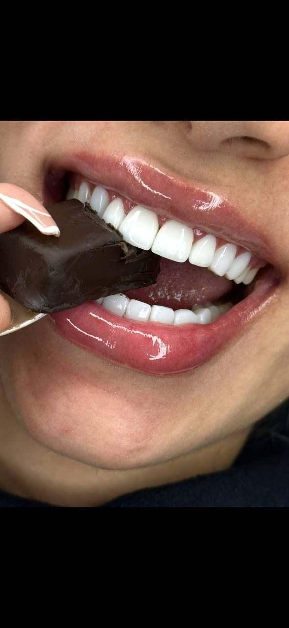دندانپزشکی/کامپوزیت/لمینیت/ایمپلنت|خدمات آرایشگری و زیبایی|تهران, قبا|دیوار