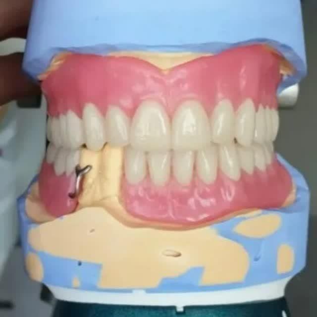 ساخت دندان مصنوعی|آرایشی، بهداشتی، درمانی|لردگان, |دیوار