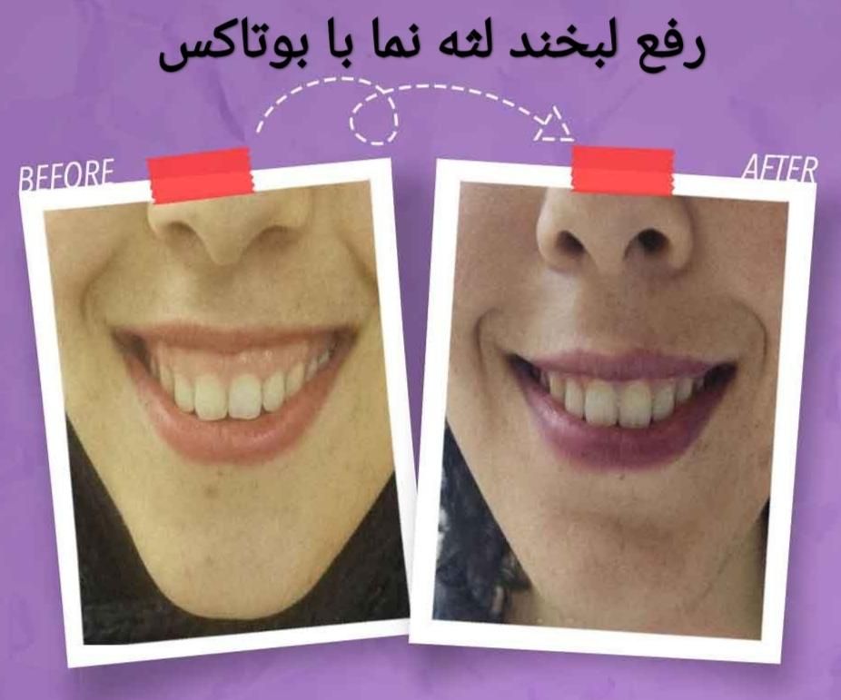 خدمات زیبایی جامع با بهترین کیفیت|خدمات آرایشگری و زیبایی|اصفهان, شاهزاده ابراهیم|دیوار