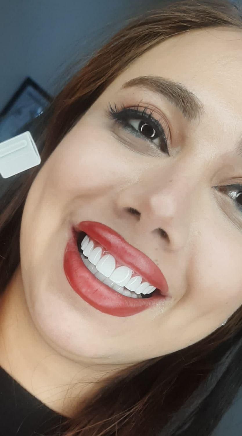 کامپوزیت دندان یاسوج|خدمات آرایشگری و زیبایی|یاسوج, |دیوار