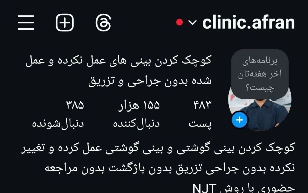 ضبط ویدیو ۱ دقیقه برای پیج دورکاری|استخدام هنری و رسانه|تهران, آذربایجان|دیوار