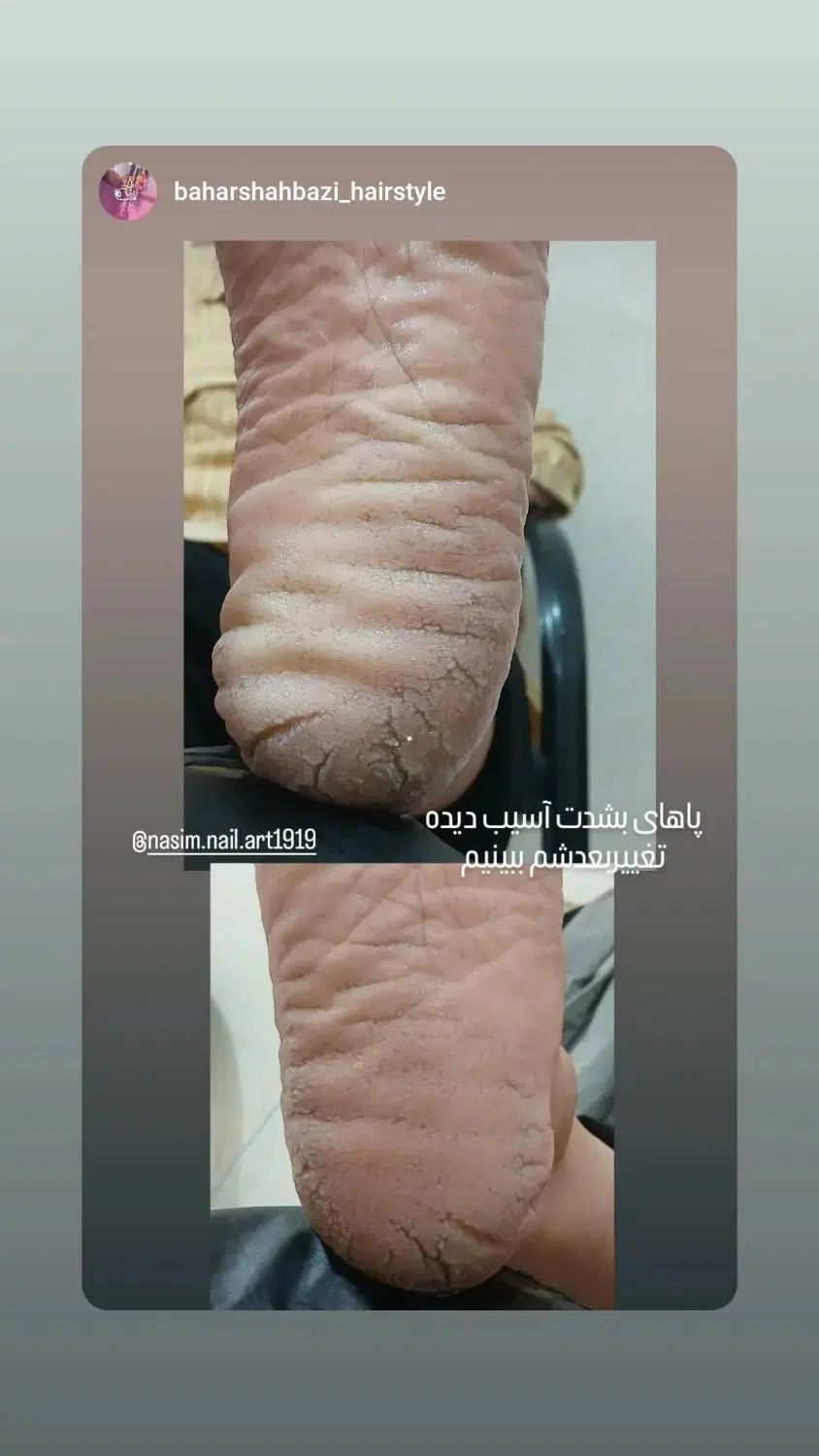 تخفیفات ویژه خدمات کاشت ناخن و پدیکور تخصصی|خدمات آرایشگری و زیبایی|اسلام‌‌آباد غرب, |دیوار