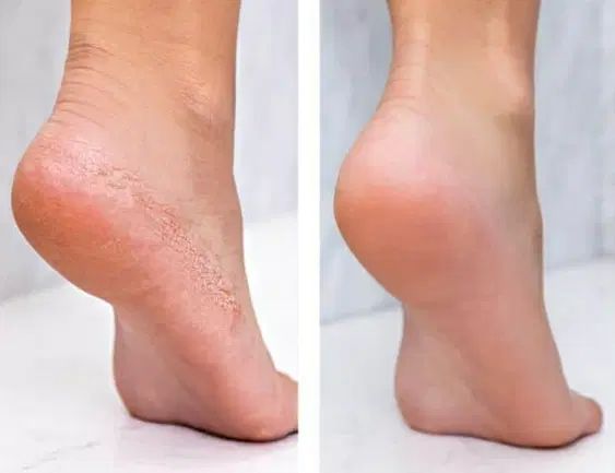 آموزش رنگ لایت کفسابی پا میکاپ فشیال کراتین|خدمات آرایشگری و زیبایی|مشهد, صیاد شیرازی|دیوار