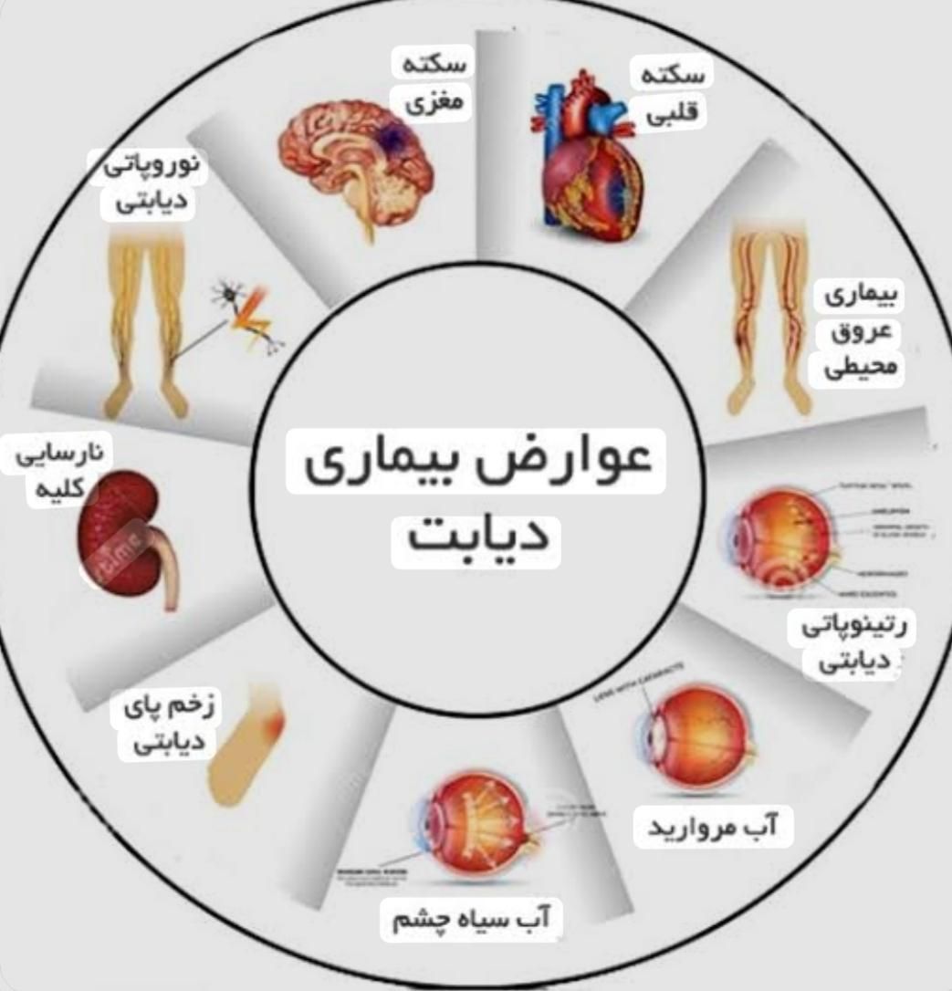 درمان دیابت نوع ۲ و کنترل رو به بهبود دیابت نوع ۱|خدمات آرایشگری و زیبایی|شیراز, مهدی‌آباد|دیوار