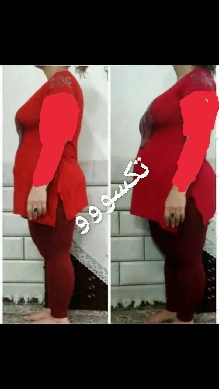 لاغری ،کاهش اشتها پاکسازی کبد، کیست و تنبلی تخمدان|آرایشی، بهداشتی، درمانی|تهران, یوسف‌آباد|دیوار