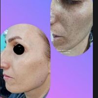 ازبین بردن کک ومک تضمینی در یک جلسه|خدمات آرایشگری و زیبایی|گالیکش, |دیوار